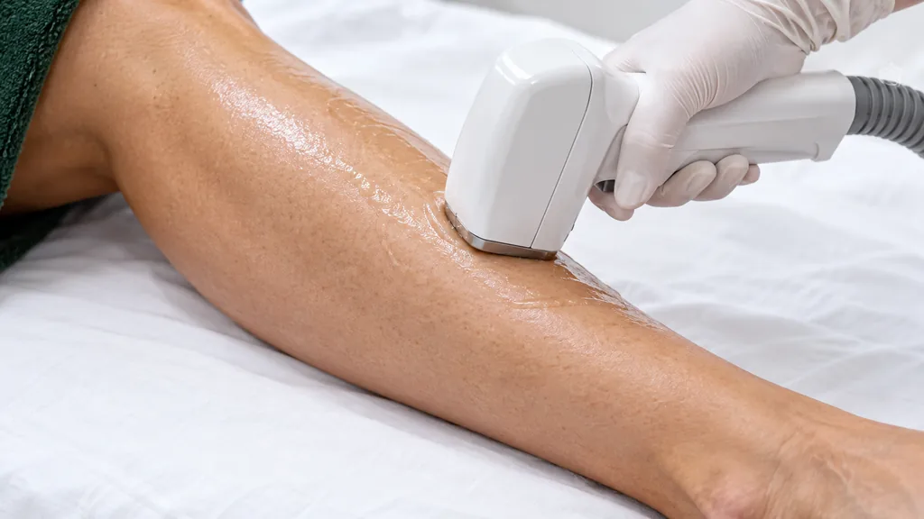 Mão com luva a segurar um aplicador de depilação sobre uma perna com gel.